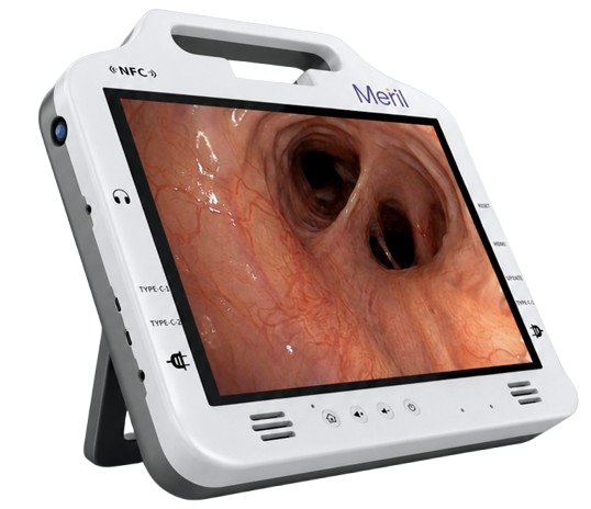 ri-spy™ 14 inch Monitor